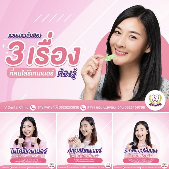 ใส่รี ไม่มีรีเทิร์น 3เรื่องที่ต้องรู้