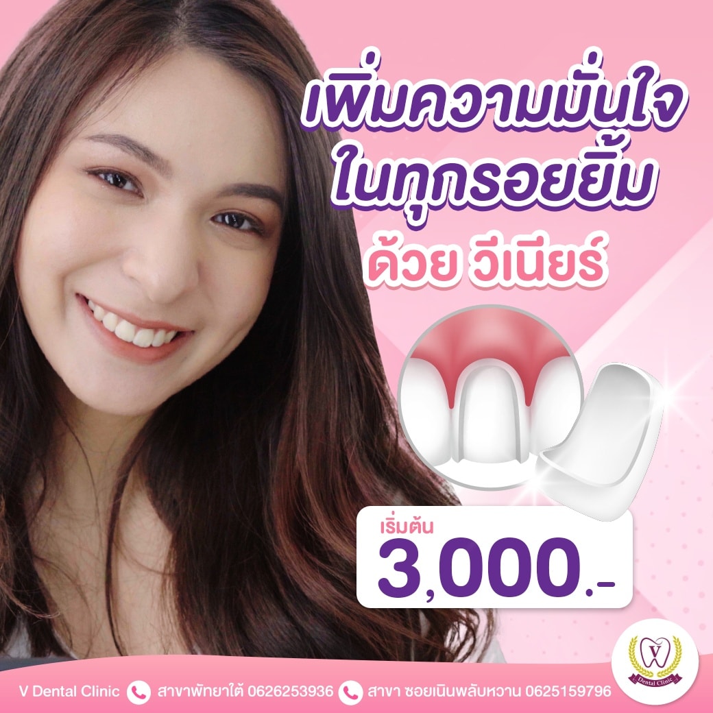 เพิ่มความมั่นใจในทุกรอยยิ้มด้วย "วีเนียร์"